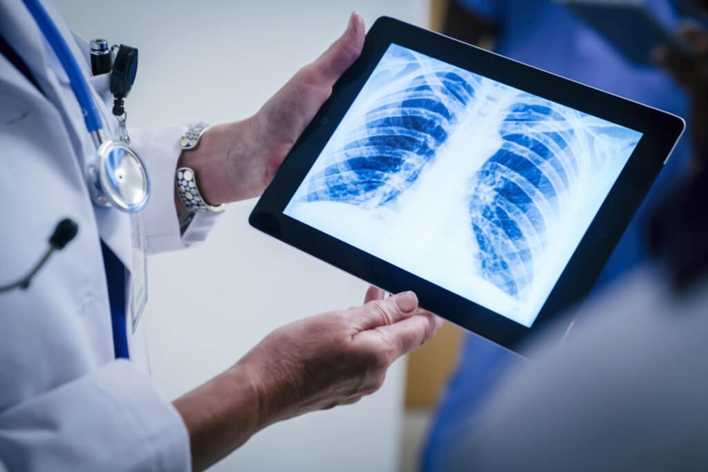 An X-ray